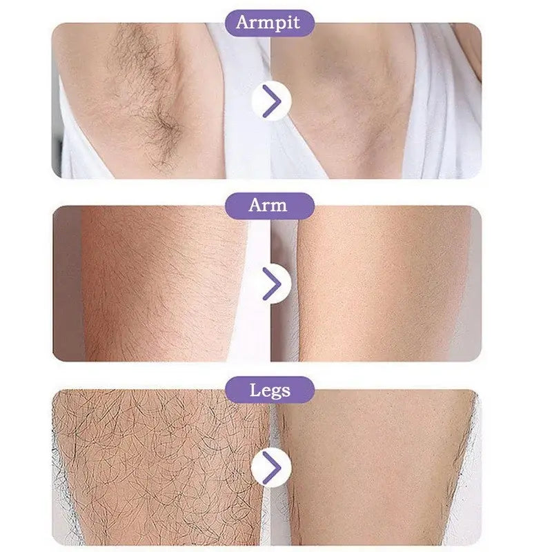 Crystal Epil Hair Removal